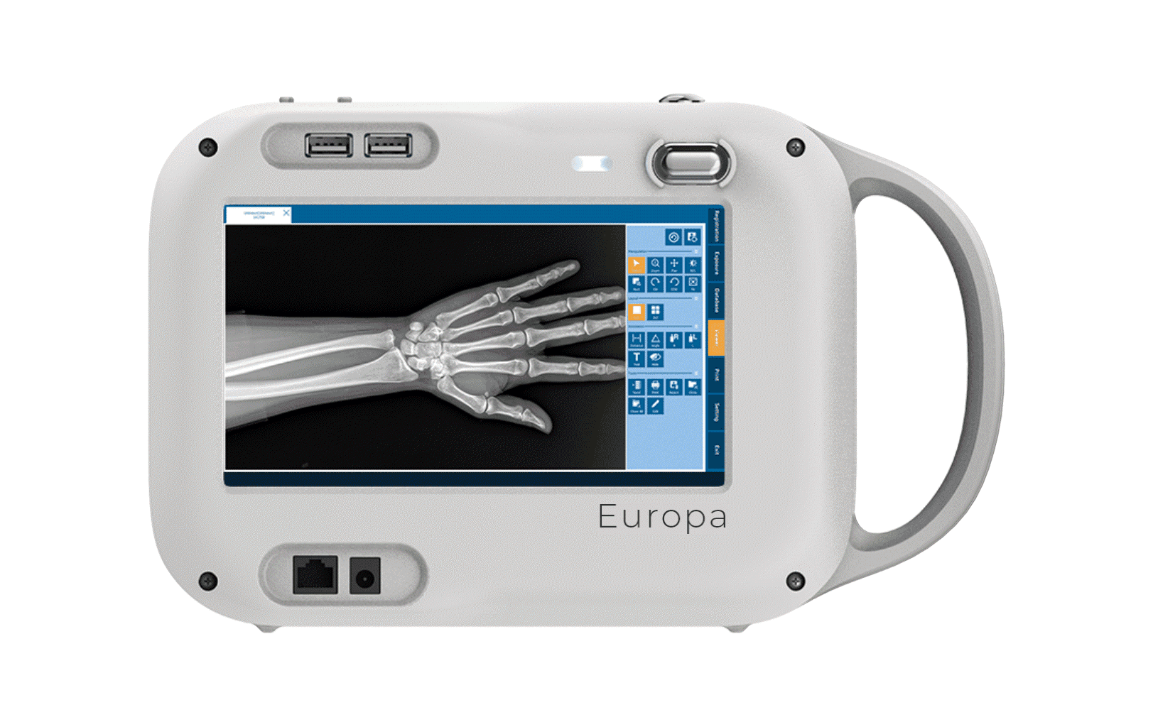 Europa 60 Portable X-Ray System